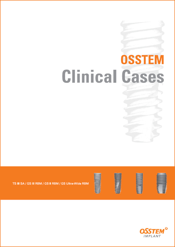 Klinická studie Osstem Clinical Cases