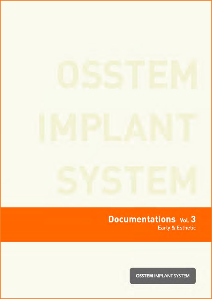 Klinická studie Osstem Implant Documentations Vol. 3