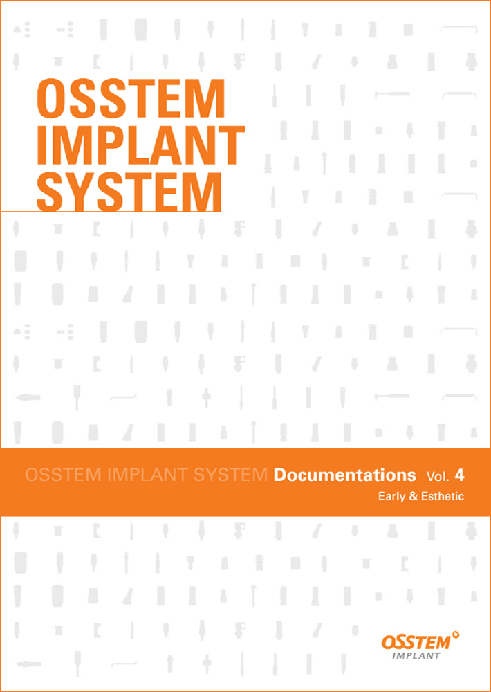 Klinická studie Osstem Implant System Vol. 4